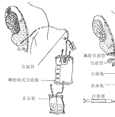 ������ѪҺ���������������й�����̽��(��125��������Ѫ��Ѫ������ջ��䱨��)