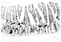 ֫��ȱѪ�ٹ����³����˵���֯ѧ�۲�