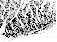 ֫��ȱѪ�ٹ����³����˵���֯ѧ�۲�