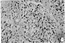 ����һ�ְ���ʽԭλPCR����