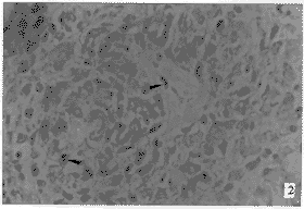 ����һ�ְ���ʽԭλPCR����