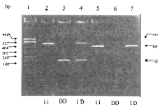 Ѫ�ܽ�����ת��ø����ȱʧ���������������������