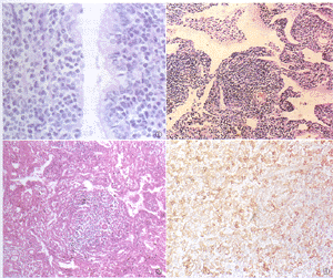 ��ճĤ������ܰ���������Լ����ٴ������������黯�о�