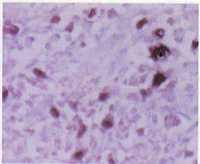 ������ܰ���EB������Ⱦ��p53���ױ���Ĺ�ϵ