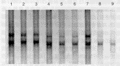 һ���ۺ�����ĸϵ�Ŵ������ϵ��������������ͻ����о�