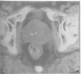 ǰ���ٶ��Ժ�ɫ����һ��