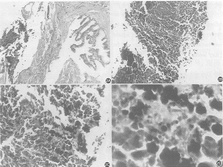 ǰ���ٶ��Ժ�ɫ����һ��