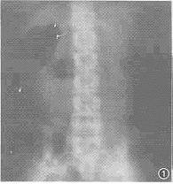 ���Ի����Ե�����һ��