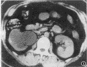 ������ʯ����������γ�