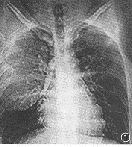 ��ǻ�޴�֬����һ��