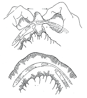 ʳ�ܰ����Ű�����Ӧ��θ��ѹ��Ӫ����ϵ��ܵ����