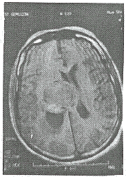 ����������CT��MRI���(��26������)