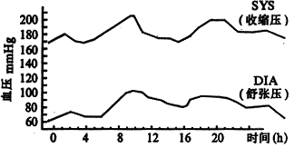 65����Ѫѹ�����ߵĶ�̬Ѫѹ�붯̬�ĵ�ͼ���շ���
