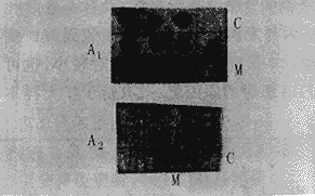 �ߵ��̴�Ѫ֢������֬����B-100ȱ�ݵļ��