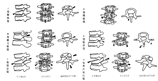 ����׵����CT��X��Ӱ���о����ۺϷ�������