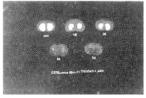 C57BLС������ɭ��ģ�Ͷ�Ͱ�ת�˵���<sup>99m</sup>Tc-TRODAT-1��������Ӱ�о�