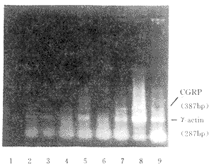 ʵ����SAH��CVS��������֯CGRP mRNA�����о�