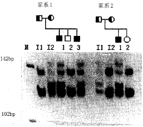 Ӧ��D13S296λ���̬�ԶԸζ�״�˱��Լ�ϵ�Ļ������