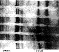 ����ʡθ���߷��������ݸ˾���Ⱦ��θ��������ͻ��֮��Ĺ�ϵ