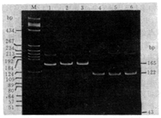 �ۺ�ø����Ӧ���Taq ��ø�з�����⵽һ����Ѫ���Ӣ������ȵ�ͻ��