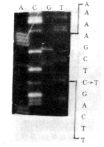 �ۺ�ø����Ӧ���Taq ��ø�з�����⵽һ����Ѫ���Ӣ������ȵ�ͻ��