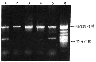 ����׳����HLA-DQB1��λ������µ��к�ƶѪ�������
