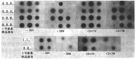 �µ��к�ƶѪ��-28(A��G)��CD17(A��T)/N��˫��ͻ���Ӻ��ӵĻ����������ϵ����