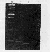 HL-60ϸ��Ig�����׵ı��ＰIgH V-D-J���з���