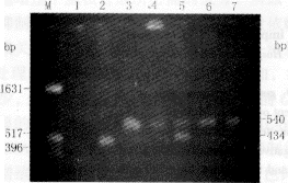 ���԰�Ѫ���������ڵ���D1mRNA���Ｐ���ٴ�����