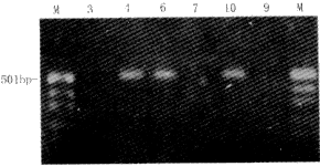 С�������ܰ�ϸ����Ѫ��p16��p15����ȱʧ��ת¼�쳣���о�