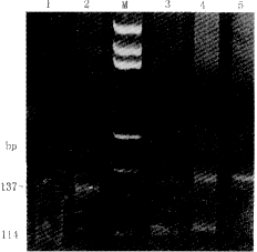 ���԰�Ѫ��bcl-2���Ｐ���ٴ�����