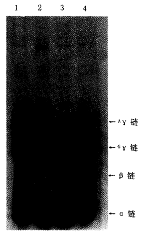 ����������2423����������Ѫ���ͦ�<sup>0</sup>���к�ƶѪ�ļ��