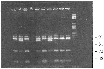 �������򲡲�����������Apo E�����̬���о�