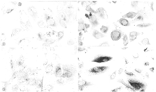 ����ϸ����������-1����С����Ƥϸ���б����ʵ���о�