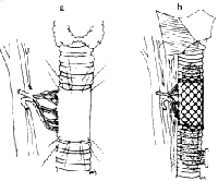����������С����ֲ������ܵ�ʵ���о�