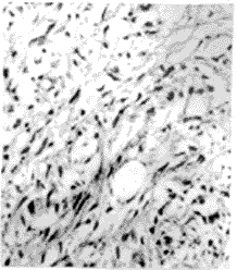 t396-3a.gif (11294 bytes)