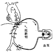 ������ת����ֹ�������˵��о�