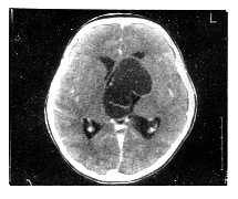 CT���嶨����ǻ�ڷ�����������­�ʹ���