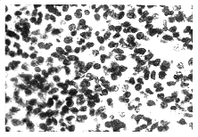 P16������������ĸϸ�����еı��Ｐ����