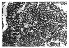 P16������������ĸϸ�����еı��Ｐ����