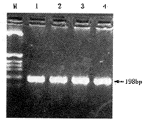 MTHFR�����̬�Լ�Ѫ��ͬ�Ͱ��װ���ˮƽ�������еĹ�ϵ