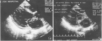 ��Ⱦ������Ĥ�׵���������-����һ��