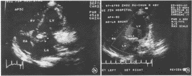 ��Ⱦ������Ĥ�׵���������-����һ��