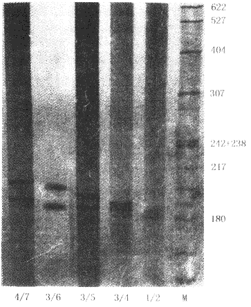 1��Ⱦɫ���ϸ�Ѫѹ���׸л���Ķ�λ�о�(���ϵͬ���Է���)