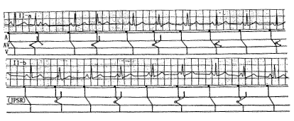 ���������ķ�����