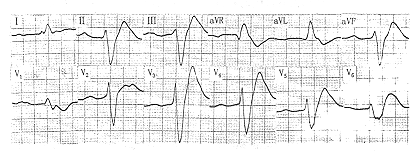 ������ͪ�ж�������ಿλ������Դ���ݿ�һ��