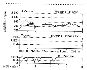 �ɶ������仯��Ӧ�ıջ�Ƶ����Ӧ���������ٴ�Ӧ��
