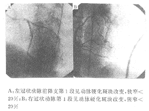 �ƽ���˶������շ���״�������κϲ��߶ȷ�������һ��