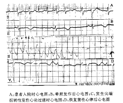 �����������ͪ�¼��Ťת�������Ķ�����һ��