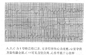 �ظ�����ж��¶��������Ķ���������һ��